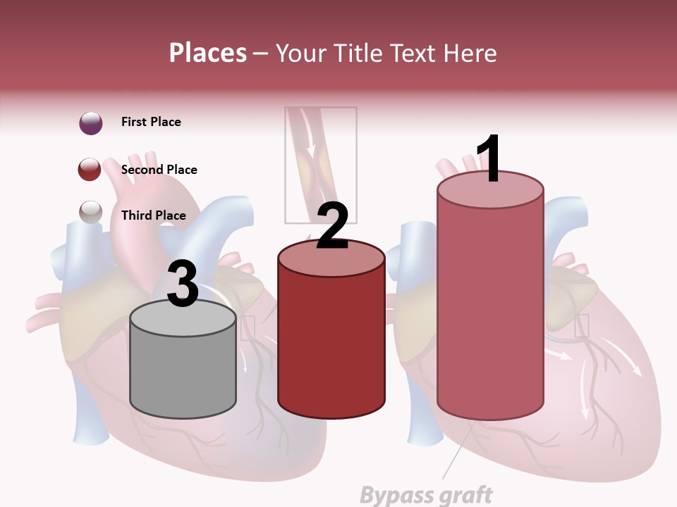 Clogged Heartbeat Illustration PowerPoint Template