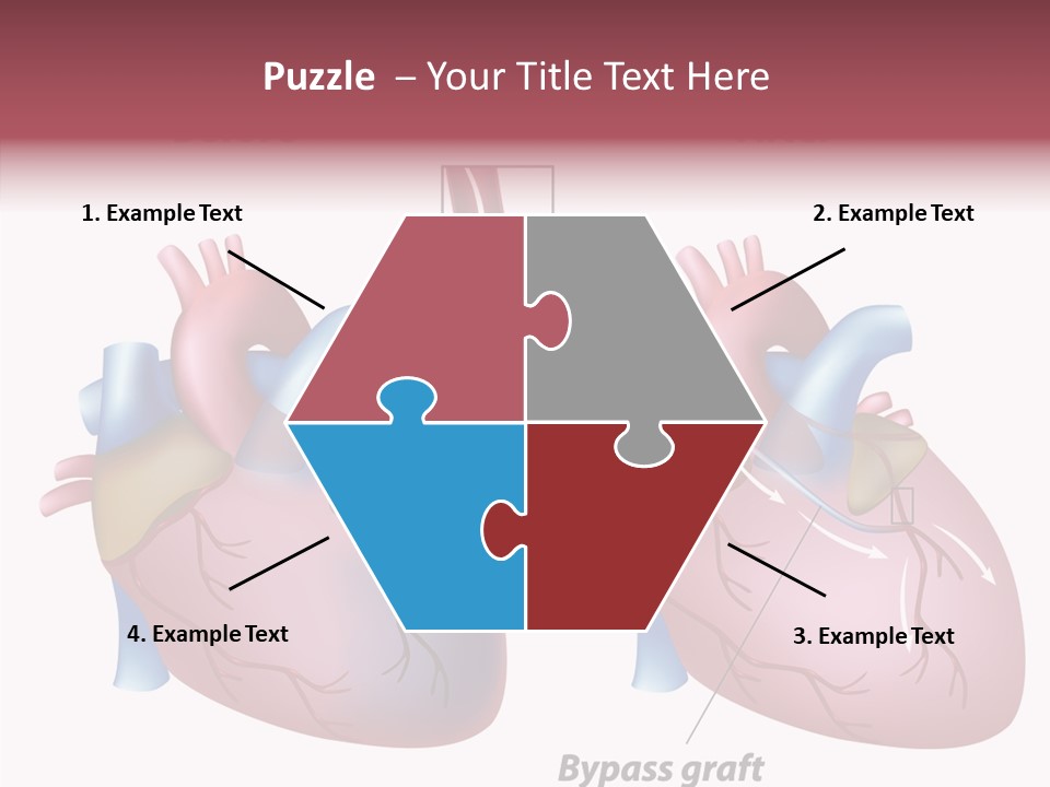Clogged Heartbeat Illustration PowerPoint Template