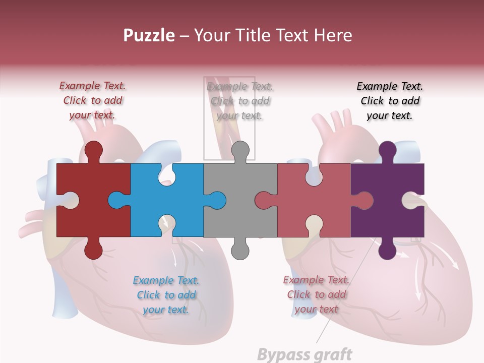 Clogged Heartbeat Illustration PowerPoint Template