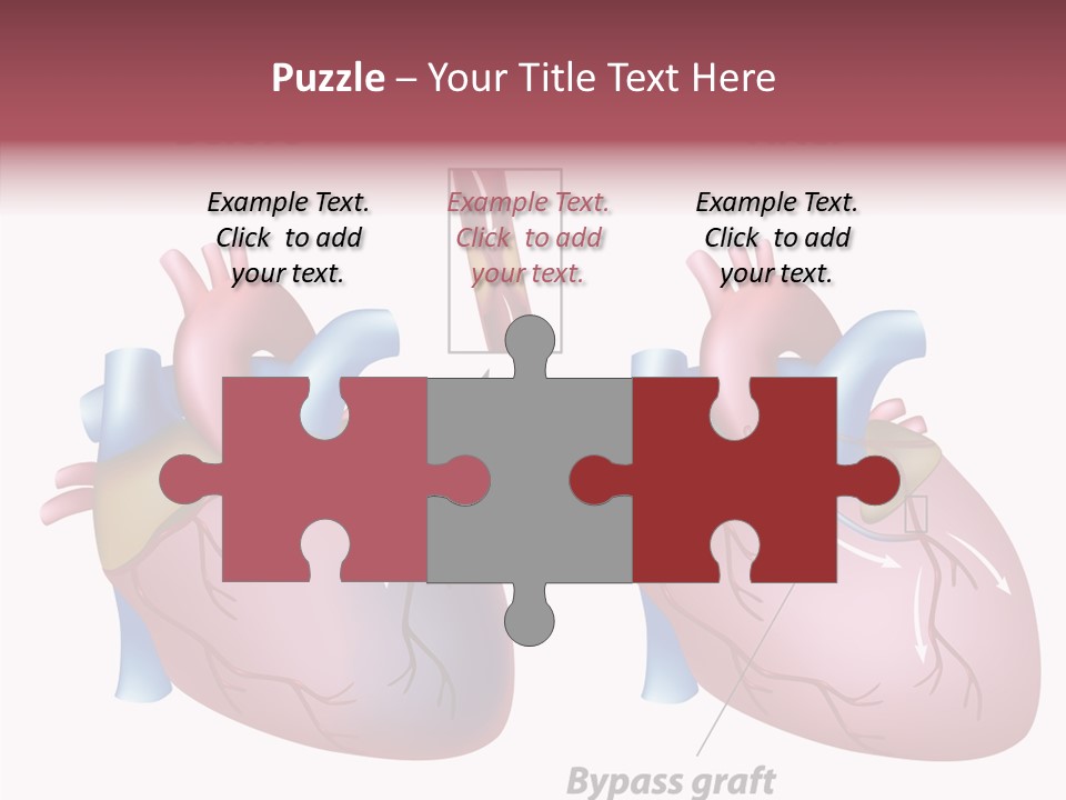 Clogged Heartbeat Illustration PowerPoint Template