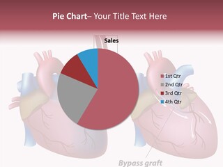 Clogged Heartbeat Illustration PowerPoint Template