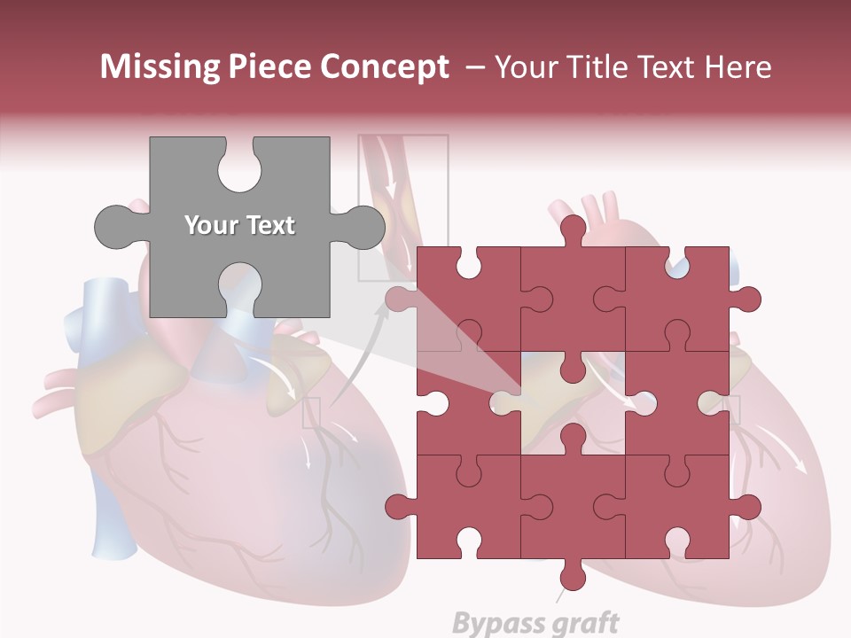 Clogged Heartbeat Illustration PowerPoint Template