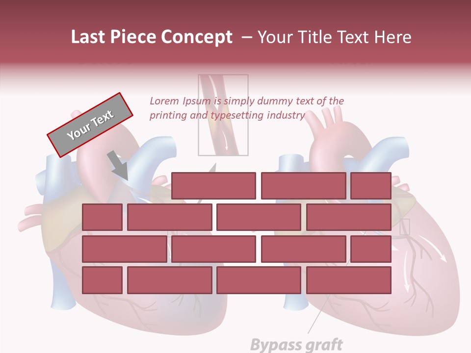 Clogged Heartbeat Illustration PowerPoint Template