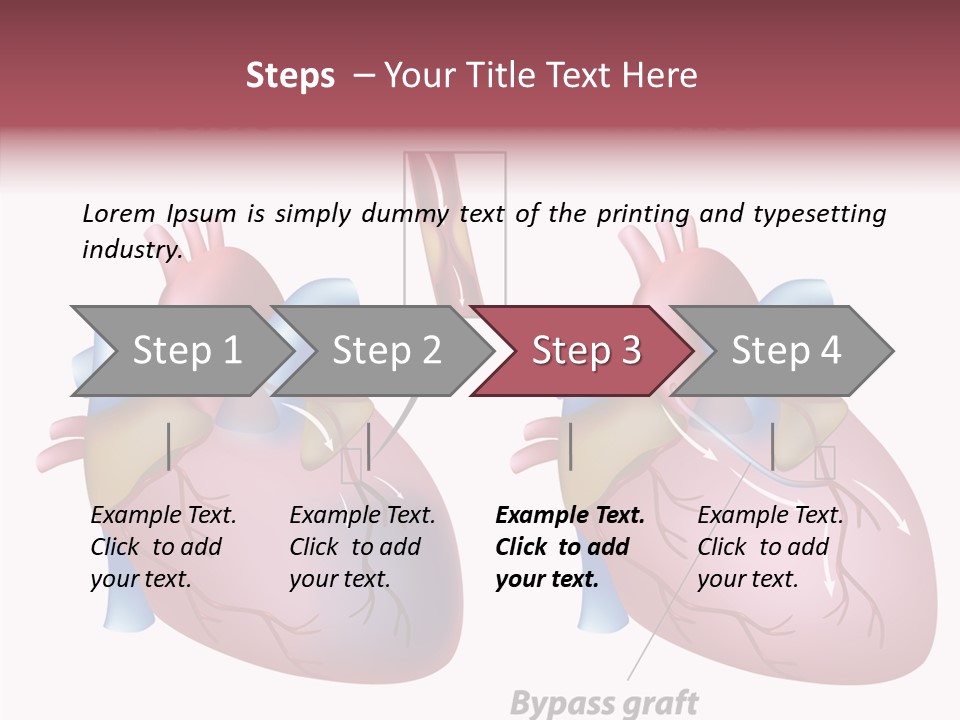 Clogged Heartbeat Illustration PowerPoint Template