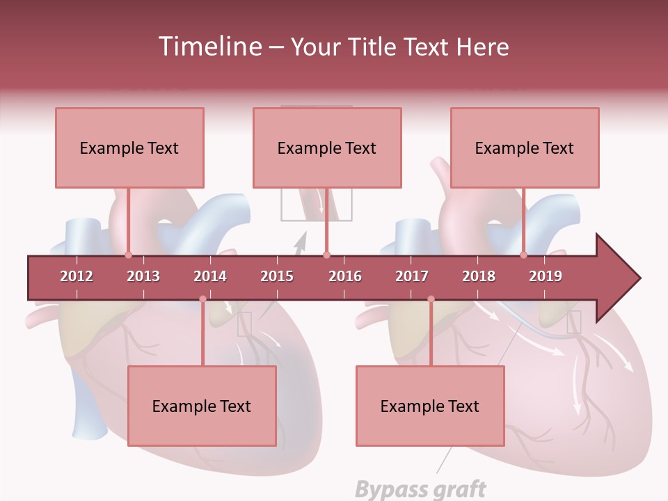 Clogged Heartbeat Illustration PowerPoint Template