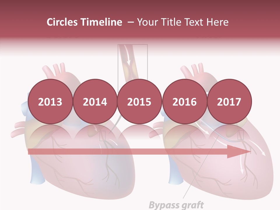 Clogged Heartbeat Illustration PowerPoint Template