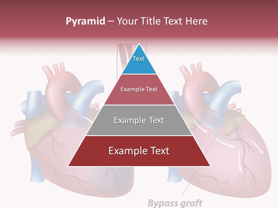 Clogged Heartbeat Illustration PowerPoint Template