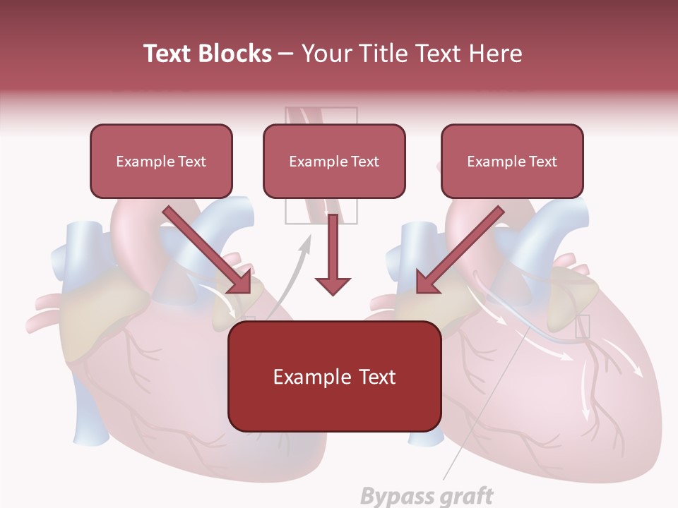 Clogged Heartbeat Illustration PowerPoint Template