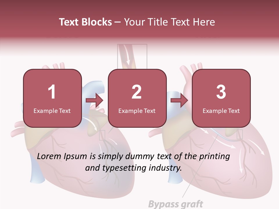 Clogged Heartbeat Illustration PowerPoint Template