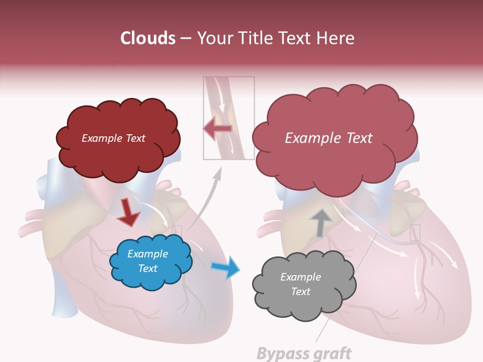 Clogged Heartbeat Illustration PowerPoint Template