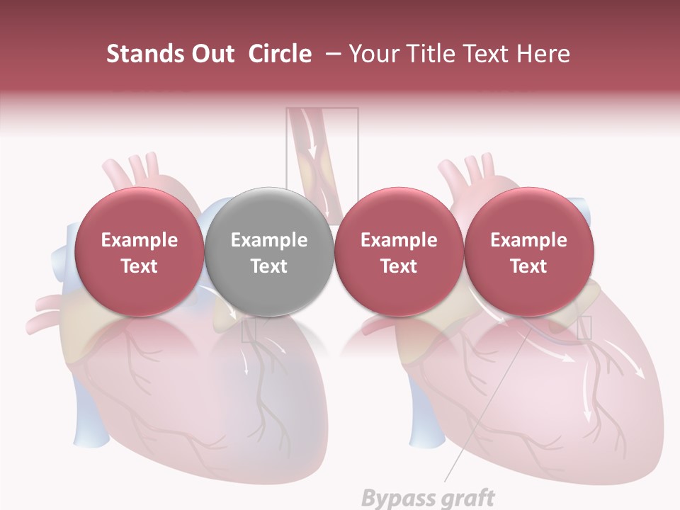 Clogged Heartbeat Illustration PowerPoint Template