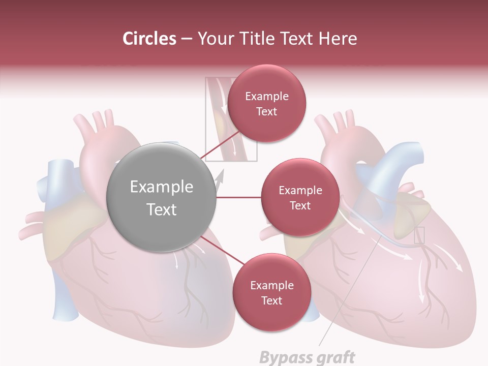 Clogged Heartbeat Illustration PowerPoint Template