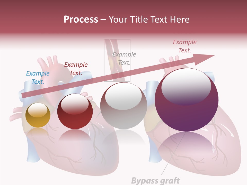 Clogged Heartbeat Illustration PowerPoint Template