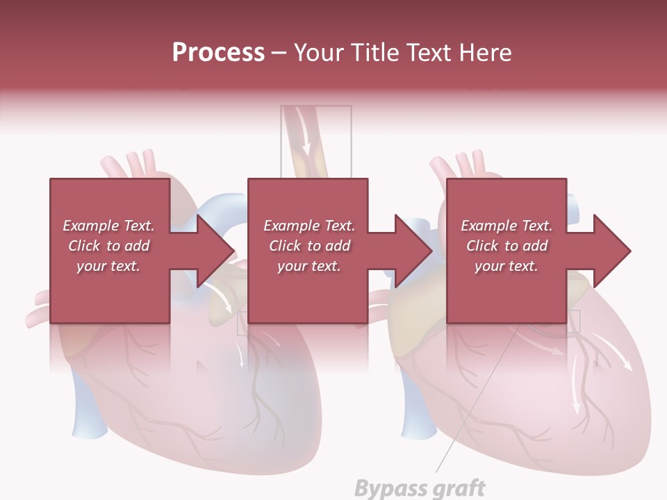 Clogged Heartbeat Illustration PowerPoint Template