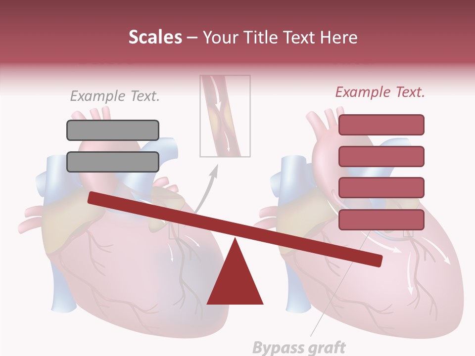 Clogged Heartbeat Illustration PowerPoint Template
