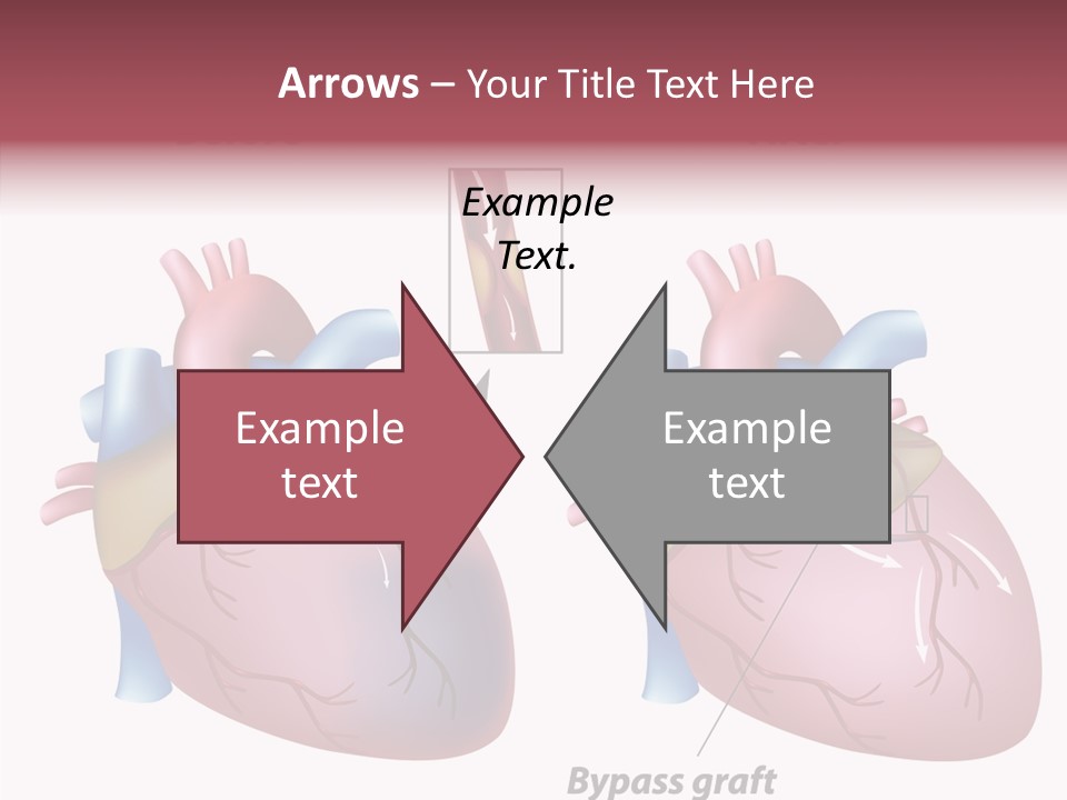 Clogged Heartbeat Illustration PowerPoint Template