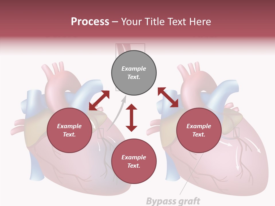 Clogged Heartbeat Illustration PowerPoint Template