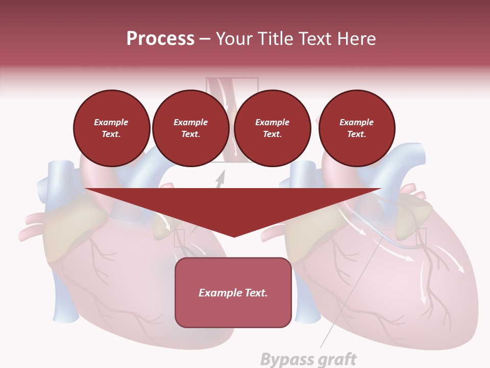 Clogged Heartbeat Illustration PowerPoint Template