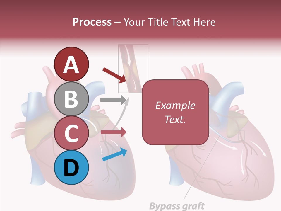 Clogged Heartbeat Illustration PowerPoint Template