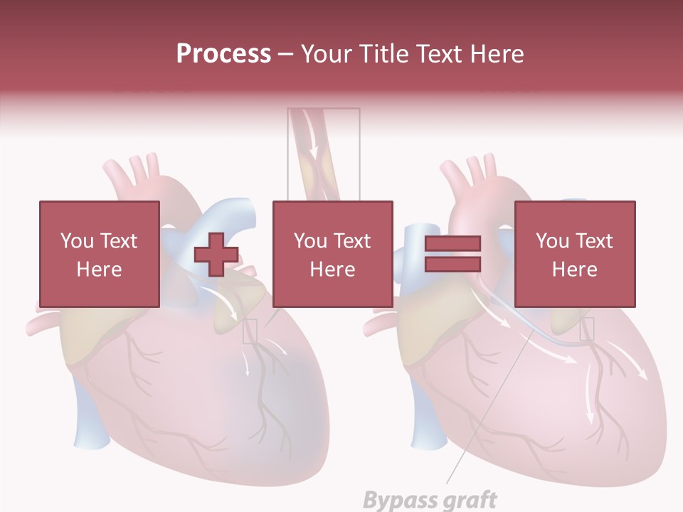 Clogged Heartbeat Illustration PowerPoint Template