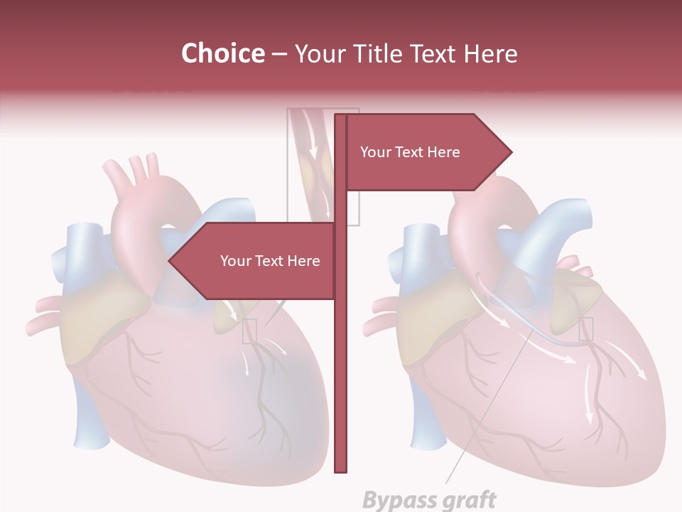 Clogged Heartbeat Illustration PowerPoint Template