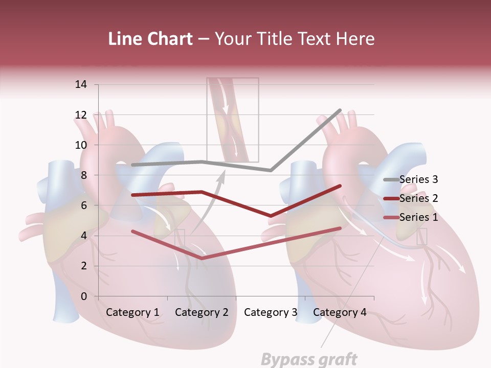 Clogged Heartbeat Illustration PowerPoint Template
