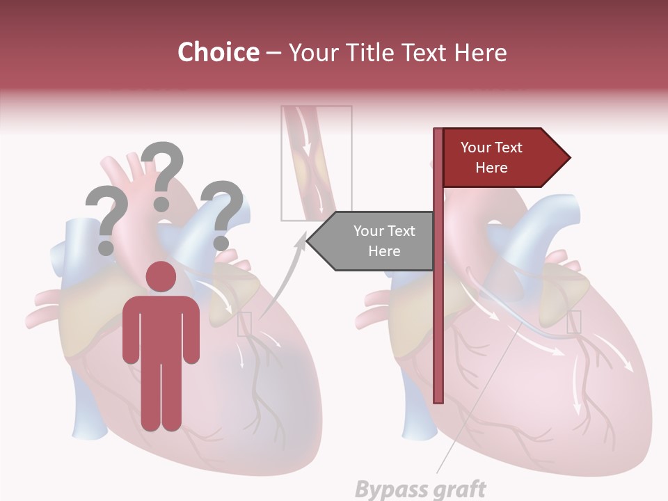 Clogged Heartbeat Illustration PowerPoint Template