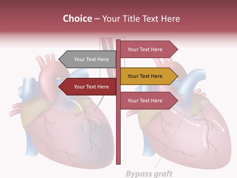 Clogged Heartbeat Illustration PowerPoint Template