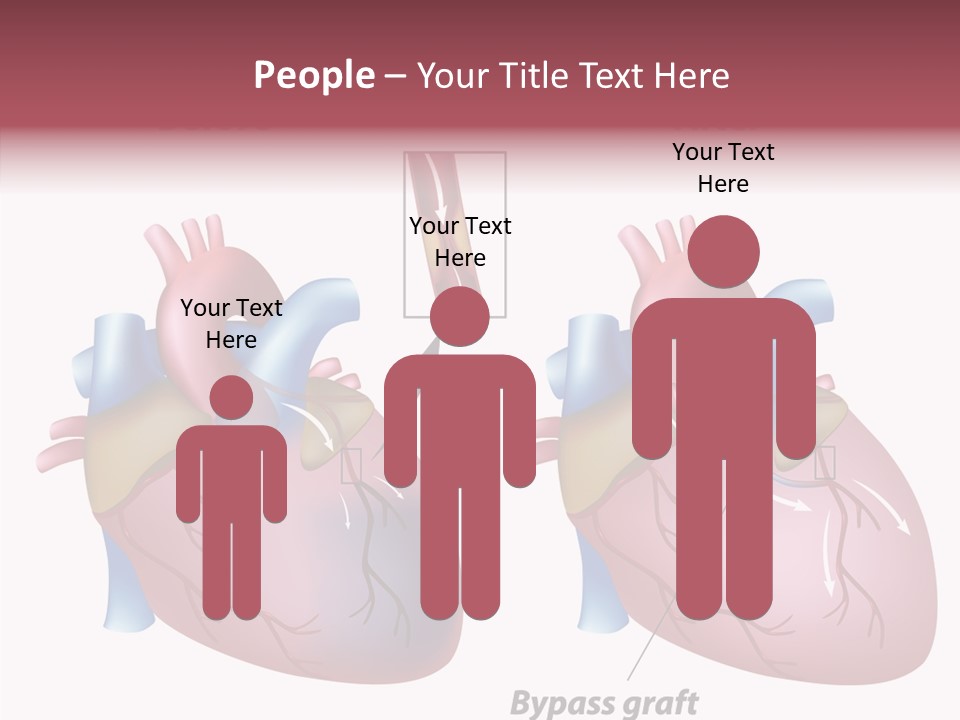 Clogged Heartbeat Illustration PowerPoint Template
