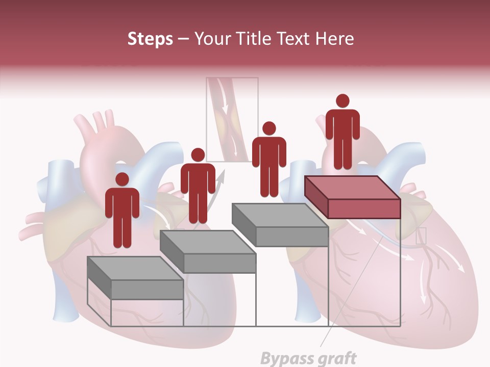 Clogged Heartbeat Illustration PowerPoint Template