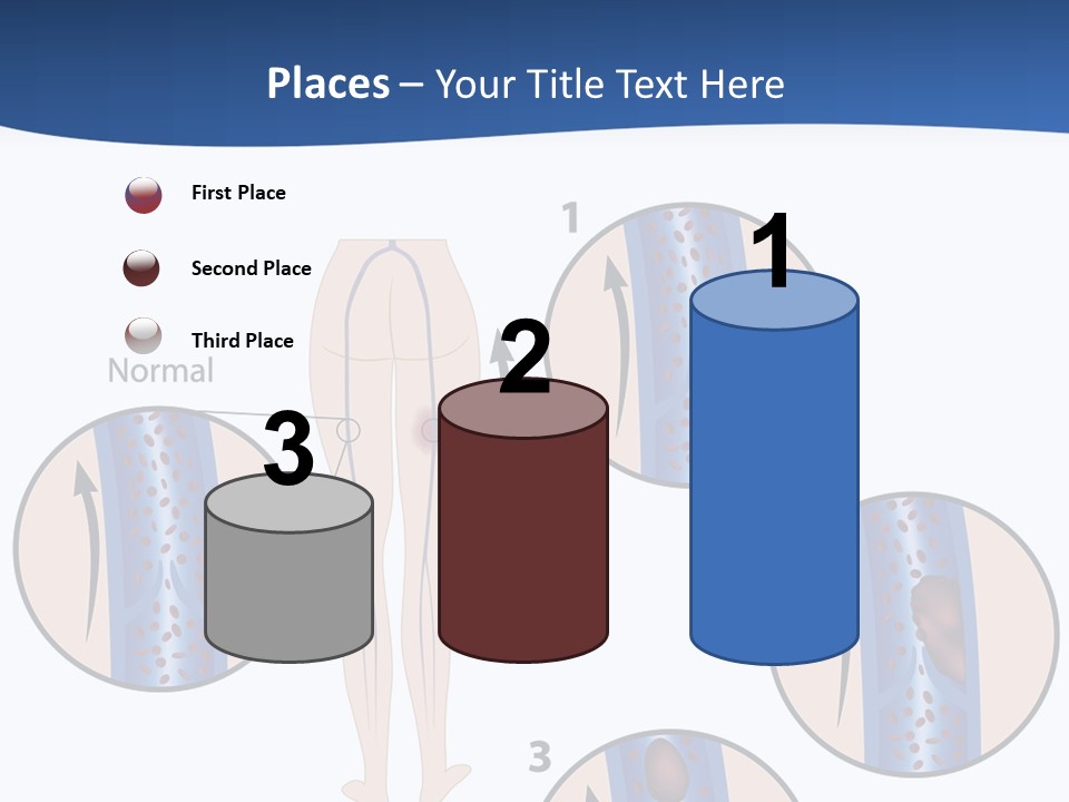 Lung Science Problem PowerPoint Template