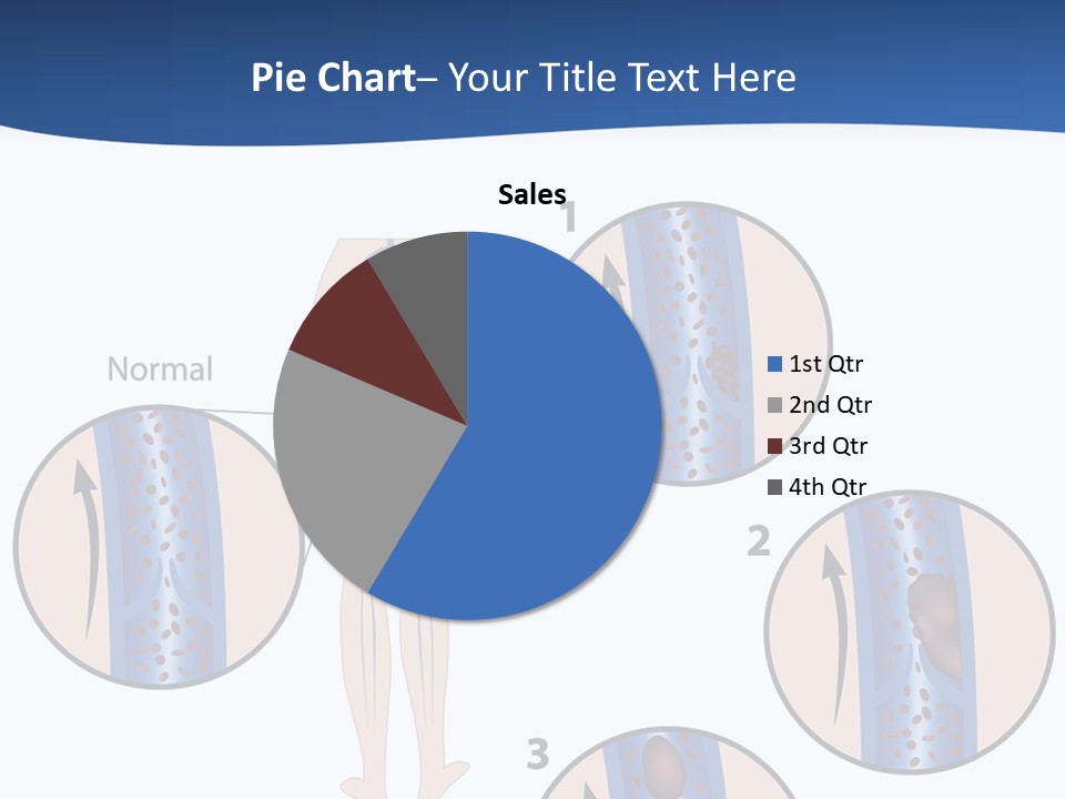 Lung Science Problem PowerPoint Template