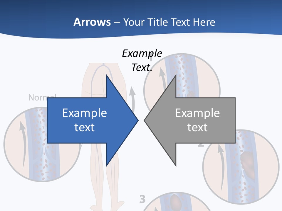 Lung Science Problem PowerPoint Template