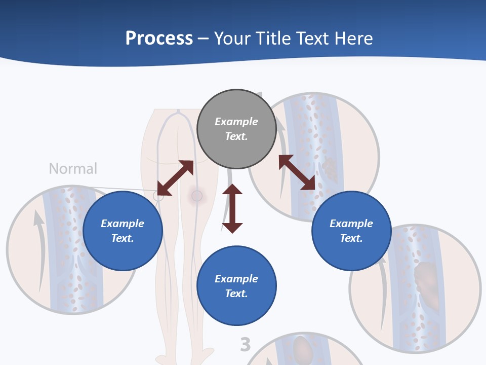 Lung Science Problem PowerPoint Template