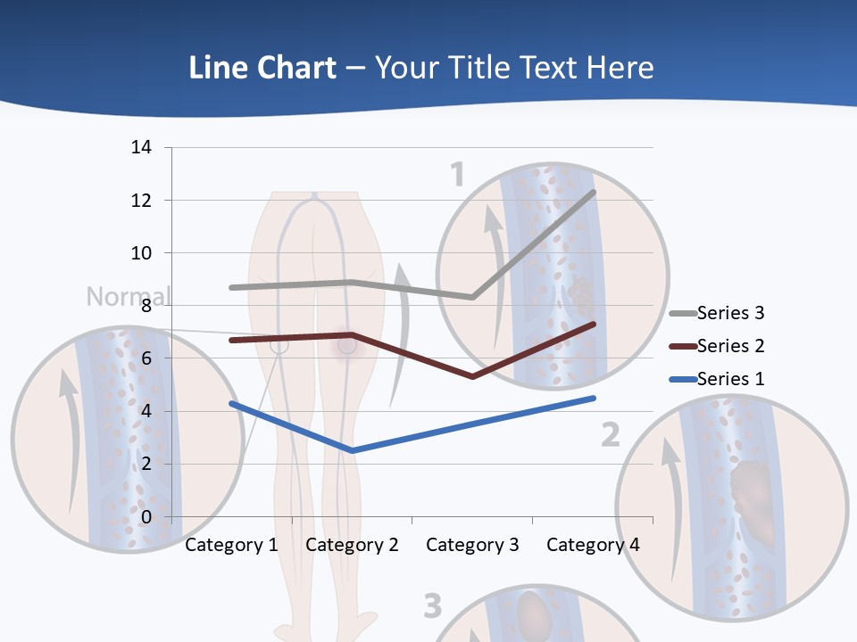 Lung Science Problem PowerPoint Template