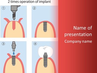 Modern Prosthesis Technology PowerPoint Template