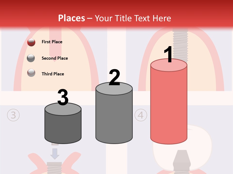 Modern Prosthesis Technology PowerPoint Template