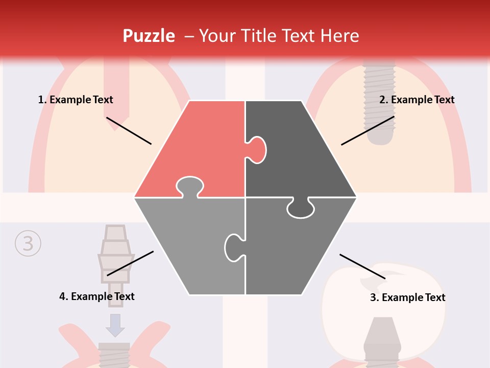 Modern Prosthesis Technology PowerPoint Template