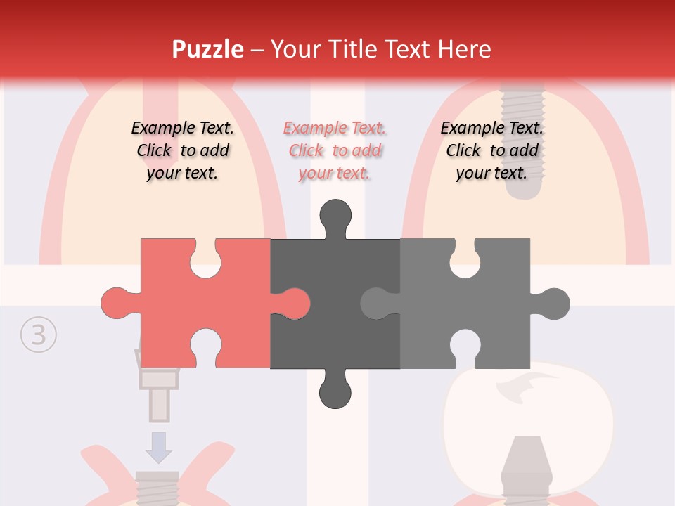 Modern Prosthesis Technology PowerPoint Template