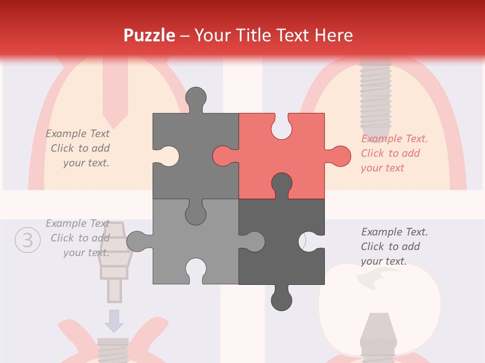 Modern Prosthesis Technology PowerPoint Template