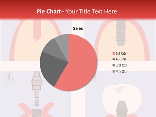 Modern Prosthesis Technology PowerPoint Template