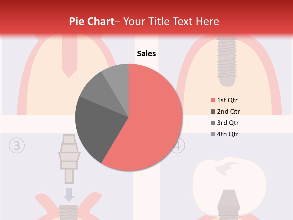 Modern Prosthesis Technology PowerPoint Template