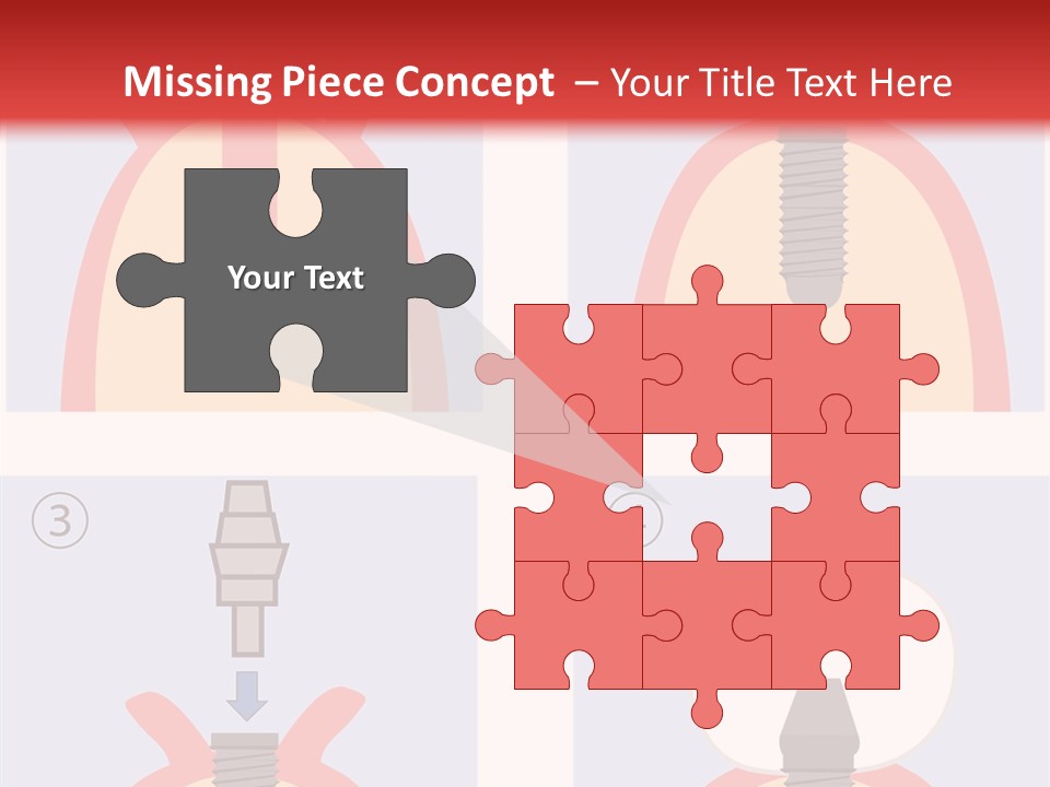 Modern Prosthesis Technology PowerPoint Template