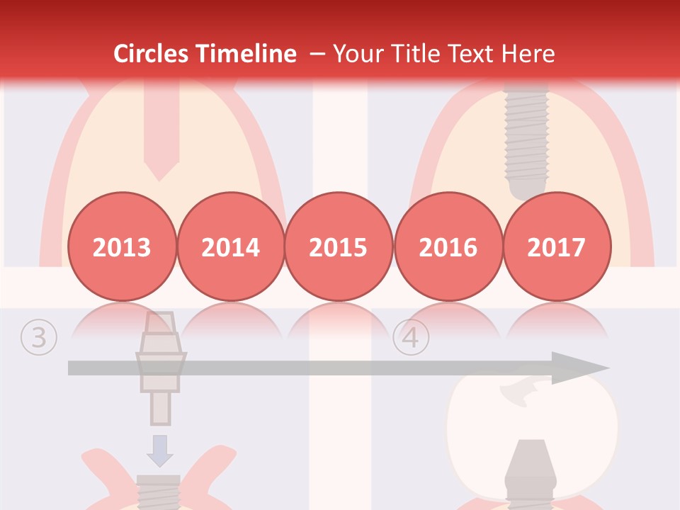 Modern Prosthesis Technology PowerPoint Template