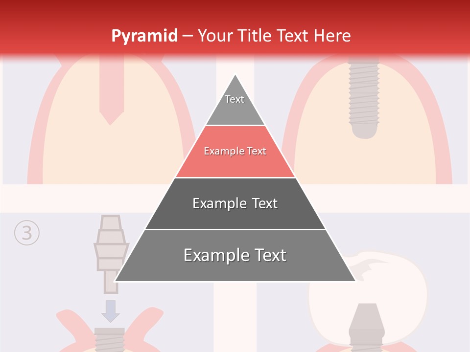 Modern Prosthesis Technology PowerPoint Template