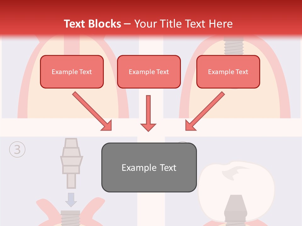 Modern Prosthesis Technology PowerPoint Template