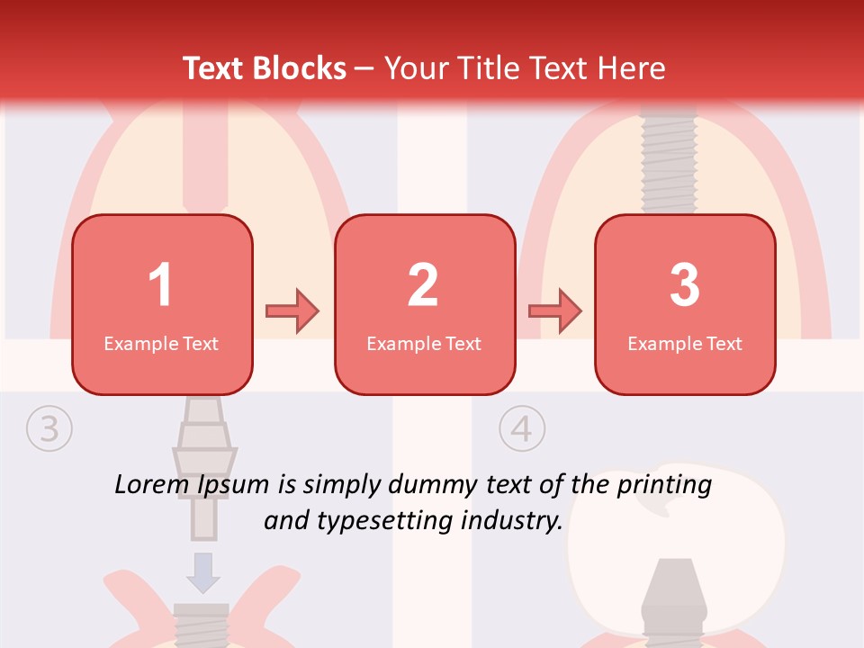 Modern Prosthesis Technology PowerPoint Template