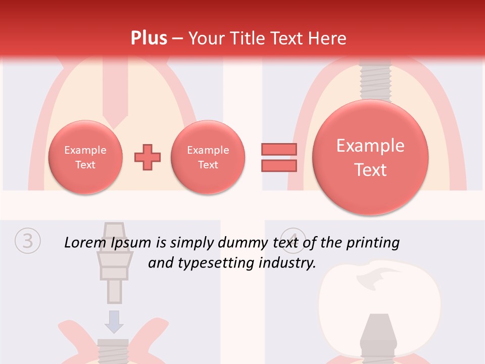 Modern Prosthesis Technology PowerPoint Template