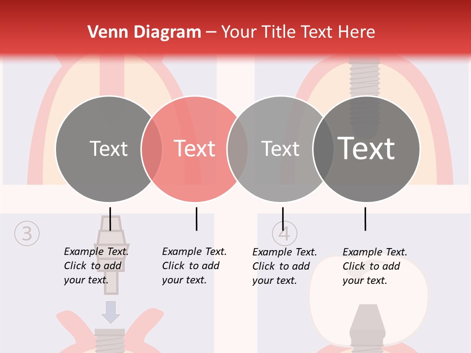 Modern Prosthesis Technology PowerPoint Template