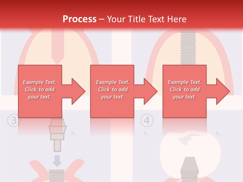 Modern Prosthesis Technology PowerPoint Template